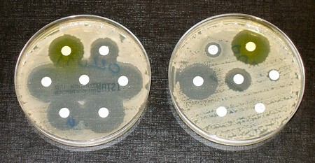 Prueba Bacterias
