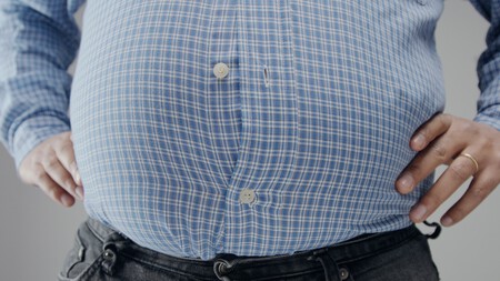 El Hombre Con Sobrepeso En Shrt Es Pequeno Para El Con Una Barriga Enorme Y Botones Abiertos