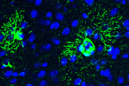 proteinas_alzheimer